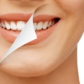 At-Home vs Professional Whitening: Which is Right for You?