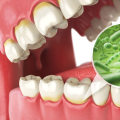 When to See a Dentist for Bad Breath