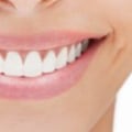 Prevent Tooth Decay: Tips for a Healthy Smile