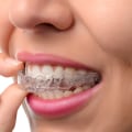 Choosing the Right Orthodontist: A Complete Guide for Optimal Dental Care