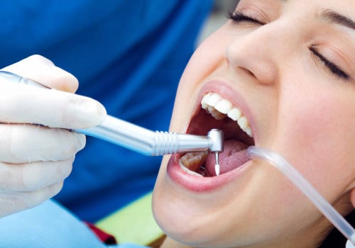 Different Types of Teeth Whitening Methods: A Comprehensive Guide for a Brighter Smile
