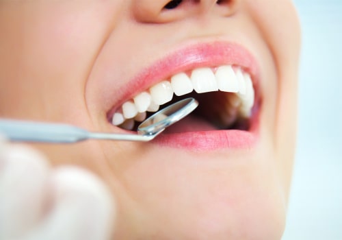 Why Regular Check-Ups are Essential for a Healthy Mouth