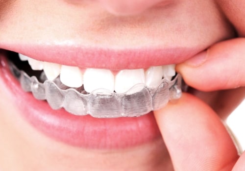 Aftercare for Invisalign and Braces: Tips for Maintaining a Healthy Smile